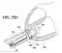 Fig. 35 - Apparatus and method for suturelessly connecting a conduit to a hollow organ