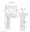 Fig. 02 - Bifurcated endoluminal prosthesis