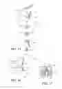 Fig. 09 - ADJUSTABLE TENSIONING SYSTEM FOR RIMLESS EYEWEAR