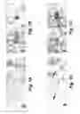 Fig. 02 - Method of treating a patient having an autoimmune disorder by administering an antibody that binds human BAFFR