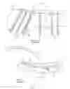 Fig. 06 - Contoured bone plate