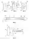 Fig. 04 - Transformable spinal implants and methods of use