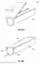 Fig. 14 - Transformable spinal implants and methods of use
