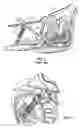 Fig. 02 - Motorcycle frame adapter