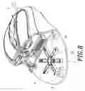 Fig. 09 - TRACK TYPE IMPACT BUFFERED INPUT DEVICE