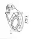 Fig. 09 - ANTI-HARMFUL IMPACT INPUT DEVICE