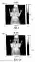 Fig. 08 - Method and system for tomographic imaging using fluorescent proteins