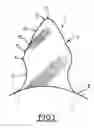 Fig. 02 - Gear tooth and external gear pump