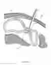 Fig. 35 - Closed loop gastric restriction devices and methods
