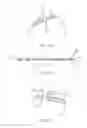Fig. 40 - Closed loop gastric restriction devices and methods