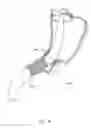 Fig. 41 - Closed loop gastric restriction devices and methods