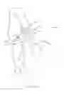 Fig. 43 - Closed loop gastric restriction devices and methods