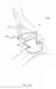 Fig. 46 - Closed loop gastric restriction devices and methods