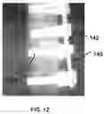 Fig. 13 - Use of bioabsorbable materials for anterior extradiscal correction of thoracolumbar pathologies