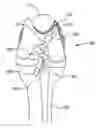 Fig. 01 - Soft Tissue to Bone Fixation