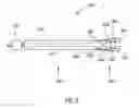 Fig. 04 - Soft Tissue to Bone Fixation