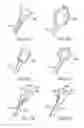 Fig. 12 - Soft Tissue to Bone Fixation