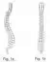 Fig. 02 - Method for improving pedicles screw placement in spinal surgery