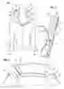 Fig. 02 - Stay for changing designs of wearable items