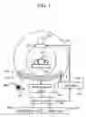 Fig. 02 - Semiconductor radiation detector with guard ring, and imaging system with this detector