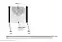 Fig. 07 - Breast compression for digital mammography, tomosynthesis and other modalities