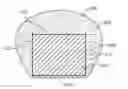 Fig. 01 - USE OF PLASMA IN FORMATION OF BIODEGRADABLE STENT COATING