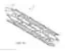Fig. 03 - USE OF PLASMA IN FORMATION OF BIODEGRADABLE STENT COATING