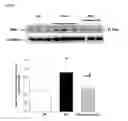 Fig. 08 - Protective role of semapimod in necrotizing enterocolitis