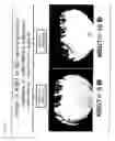 Fig. 29 - Reagent for Lacrimation Examination and Method of Lacrimation Examination
