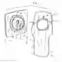 Fig. 02 - Ostomy and percutaneous catheter protective and affixation device