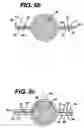 Fig. 06 - Method of using intravaginal device with fluid transport plates