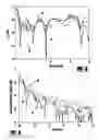 Fig. 07 - Two-Sided Overlapping Coupled Sectorial Loop Antenna