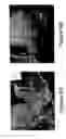 Fig. 07 - Method and system of adaptive control for reducing motion artifacts and patient dose in four dimensional computed tomography