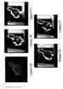 Fig. 08 - Method and system of adaptive control for reducing motion artifacts and patient dose in four dimensional computed tomography