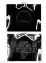 Fig. 02 - Systems and methods for performing radiosurgery using stereotactic techniques
