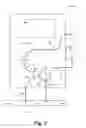 Fig. 03 - Method and device for reversing lines in the procedure of hemodialysis