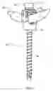 Fig. 02 - Locking device and method employing a posted member to control positioning of a stabilization member of a bone stabilization system