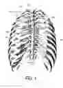 Fig. 02 - SPINE TREATMENT DEVICES AND METHODS