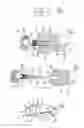 Fig. 02 - Bone fixation