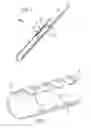 Fig. 02 - Stent Expanding device