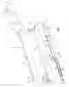 Fig. 03 - Instruments and method for minimally invasive carpal tunnel release