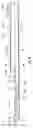 Fig. 17 - Instruments and method for minimally invasive carpal tunnel release