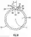 Fig. 26 - Instruments and method for minimally invasive carpal tunnel release