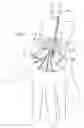 Fig. 32 - Instruments and method for minimally invasive carpal tunnel release