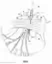 Fig. 33 - Instruments and method for minimally invasive carpal tunnel release