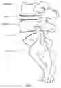 Fig. 02 - INTERVERTEBRAL LORDATIC ADAPTER