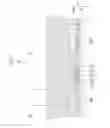 Fig. 08 - LIQUID CRYSTAL DEVICE AND ELECTRONIC APPARATUS
