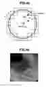 Fig. 35 - Image processing apparatus and image processing method