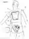 Fig. 09 - INTRAVENOUS (IV) TRAINING SYSTEM