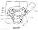 Fig. 13 - INTRAVENOUS (IV) TRAINING SYSTEM